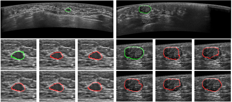 无监督学习新纪元?ChatGPT带你探索OpenAI预训练论文背后的魔力 无监督学习新纪元?ChatGPT带你探索OpenAI预训练论文背后的魔力